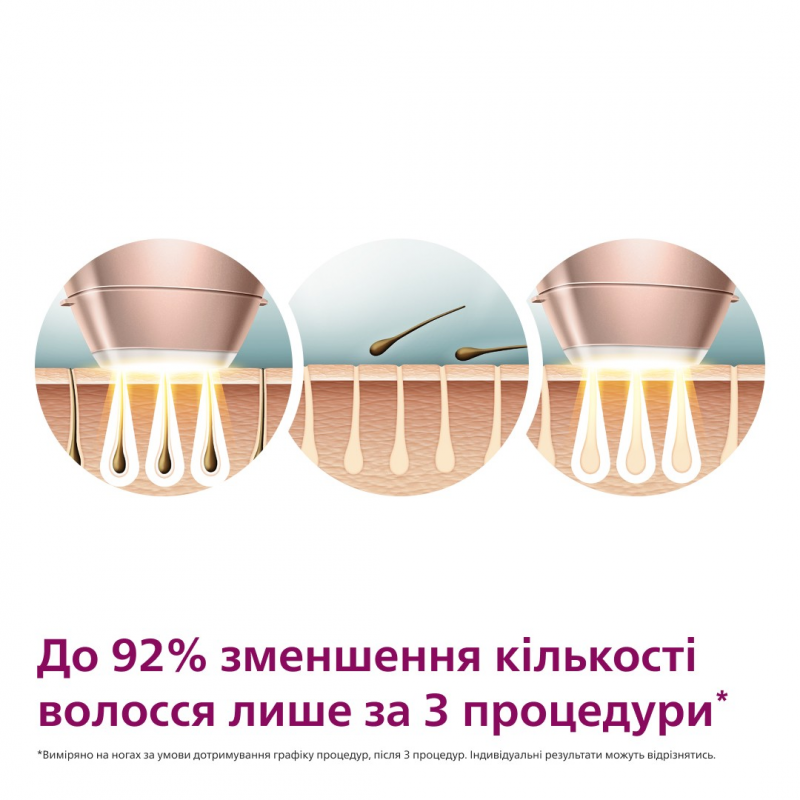 Фотоепілятор Philips Lumea IPL 9900 Series BRI977/00